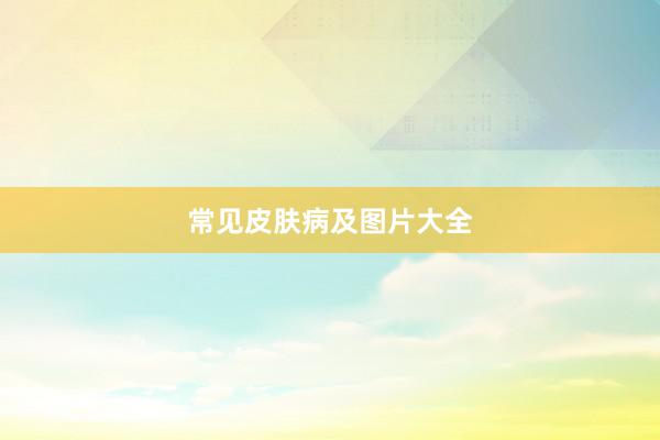 常见皮肤病及图片大全